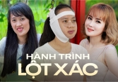 Cô giáo Bến Tre trải qua đại phẫu 11 tiếng để khắc phục 'mặt vặn xoắn', cuộc sống hiện tại giống như 'phép màu'