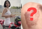 Ngọc Trinh zoom cận tình trạng những vết thương sau 4 tháng gặp tai nạn lái xe mô tô