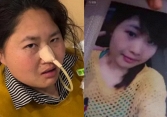 5 năm làm mukbang, ngoại hình cô gái 33 tuổi thay đổi chóng mặt khiến dân mạng cứ ngỡ bà dì trung niên: 'Dùng thân xác đổi tiền bạc'