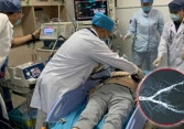 Người đàn ông có mạch máu vôi hóa như ruột bút chì, qua đời vì mê 1 thực phẩm
