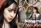 Hành trình nâng mũi 'đổi vận' của cô gái 9x: Được cả gia đình 'tháp tùng' đi thẩm mỹ và nhan sắc thay đổi bất ngờ