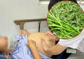Người đàn ông Phú Yên phát hiện cả 'ổ' sán lá gan trong người vì 'nghiện' một món quen thuộc với dân Việt