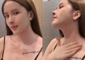 Thiều Bảo Trâm lộ bằng chứng 'dao kéo'
