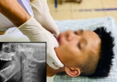 Phú Thọ: Nam thanh niên không khép miệng lại được vì ngáp lớn đến sái quai hàm