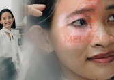 Hành trình vượt mặc cảm của nữ nhân viên văn phòng từng sống trong ám ảnh với biệt danh 'chó đốm'