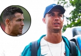 Xót xa trước tấm hình chụp cận cảnh gương mặt của Ronaldo tại Euro 2024: Huyền thoại cũng đã già!