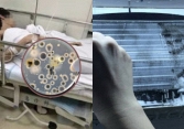 Người đàn ông nhiễm 'vi khuẩn chết người' từ điều hòa, đừng xem nhẹ những tác nhân tàn phá cả gan, thận và phổi