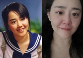 Bức ảnh gây lo lắng tột độ của 'Em gái quốc dân' Moon Geun Young