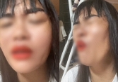 Bị tố 'vét những đồng tiền cuối cùng trong túi bệnh nhân ung thư', Bệnh viện K nói gì?