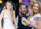 Tiểu thư Harper nhà Beckham có một khuyết điểm trên gương mặt, dùng cách giống Ánh Viên để cải thiện nhan sắc