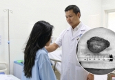 Nữ sinh 20 tuổi 'đeo' khối u khổng lồ trước cổ, chèn đường thở suốt 4 năm