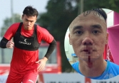 Tiền đạo ĐT Việt Nam bị đấm chảy máu mũi ở giải hạng Nhất, thực hư vụ việc thế nào?