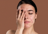 Mẹo chăm sóc da nhạy cảm khỏe mạnh hơn mùa hanh khô