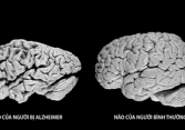 Thảo dược, tiêu dùng xanh và chiến lược chống lão hóa thần kinh (bệnh Alzheimer ) ở người cao tuổi
