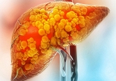 Vitamin B3, 'chìa khóa' trong điều trị gan nhiễm mỡ