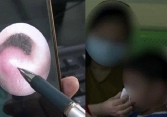 Bé 8 tuổi nhiễm trùng nội sọ, suýt mất mạng vì 1 thói quen khi rảnh rỗi
