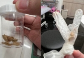 Người đàn ông hoảng hốt vì cậu nhỏ rơi ra toàn “đá”, hóa ra quên làm 1 việc suốt 30 năm