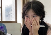 “1 sưng, 2 đen” trên khuôn mặt cho thấy thận kiệt quệ vì bệnh tật