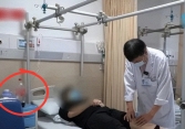 Mới 35 tuổi xương đã “xốp như tổ ong”, ho 1 cái gãy đôi xương đùi vì quá mê loại nước uống quen thuộc