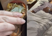 Đáng thương hơn đáng trách: Mẹ bầu 3 tháng mất con vì ăn liền một lúc 5 phần thực phẩm này