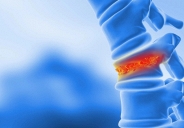 Các nhà khoa học phát triển kỹ thuật tái tạo xương từ mỡ cơ thể