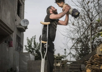Khoảnh khắc buồn vui lẫn lộn về bức ảnh hai cha con bị mất tứ chi do nội chiến ở Syria
