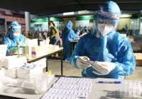 Kit test COVID-19 sẽ được bình ổn giá?