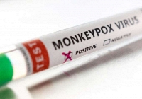 WHO: Bệnh đậu mùa khỉ có nguy cơ vừa phải đối với sức khỏe cộng đồng