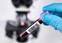 Trứng gà có thể chống lại sự lây nhiễm của coronavirus?