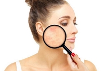 Skin Microbiome - Xu hướng mới của ngành mỹ phẩm chăm sóc da