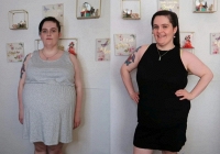 Tưởng mang thai, người phụ nữ không ngờ mình bị u nang buồng trứng nặng 16kg