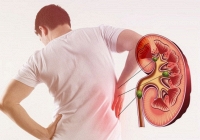 Suy thận ở thanh thiếu niên và dấu hiệu cảnh báo sớm