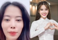 Thẩm mỹ lỗi chi tiết nào trên gương mặt mà khiến Nam Em ngày càng khác lạ và lời khuyên của chuyên gia khi làm đẹp