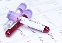 Tìm ra chỉ dấu sinh học mới giúp cải thiện phương pháp điều trị ung thư nội mạc tử cung