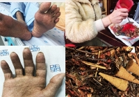 Đốt thuốc bắc xông nhà, 1 người suýt tử vong vì ngộ độc thạch tín 