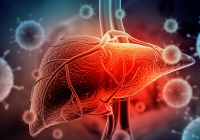  Nghiên cứu Lancet: 3/5 ca ung thư gan có thể phòng ngừa