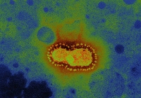 Coronavirus - 'Nỗi sợ của những điều chưa biết' và những tia sáng hi vọng