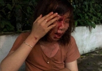 Người phụ nữ mang thai 4 tháng bị hàng xóm đánh trọng thương vì... đường lầy lội