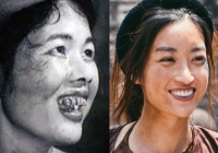 'Hết Thương Cạn Nhớ', Đỗ Mỹ Linh hóa Thị Nở