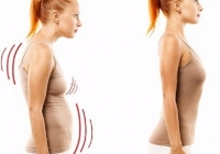 Bài tập ngăn ngừa gù lưng, cải thiện tư thế