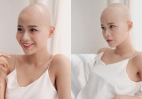 Hành trình chiến đấu với bệnh ung thư của nữ sinh 20 tuổi ĐH Ngoại thương