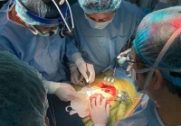 Bệnh viện Nhi Trung ương đã ghép gan thành công cho hai bệnh nhi 