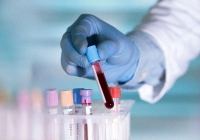 Nghiên cứu mới: Virus Covid-19 có thể tồn tại gần 1 tháng trong cơ thể bệnh nhân