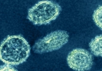Chuyên gia cảnh báo virus H1N1 ở Trung Quốc có thể gây ra đại dịch