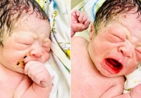 Sự thật về bức ảnh bé sơ sinh chào đời cầm vòng tránh thai gây xôn xao MXH