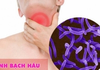 Bé trai mắc bệnh bạch hầu ở Gia Lai đã tử vong