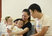 Những ca phẫu thuật tách cặp song sinh nổi tiếng trong lịch sử ngành Y Việt Nam