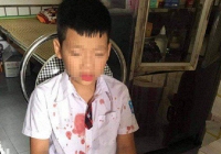 Phụ huynh học sinh lớp 1 bị hành hung: 'Tinh thần cháu vẫn hoảng loạn, không muốn đến trường'