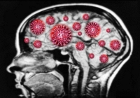 Nghiên cứu mới: Virus Covid-19 có thể xâm nhập vào não