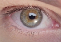 Cụ ông 78 tuổi bị mù suốt 10 năm đã hồi phục thị giác nhờ cấy ghép giác mạc nhân tạo